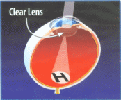 Normal Eye Lens